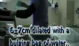 女人分娩视频,见证生命诞生的震撼瞬间